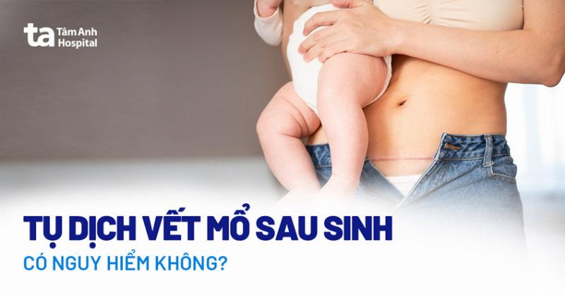 Khuyết Sẹo Mổ Lấy Thai Có Nguy Hiểm Không Và Những Điều Cần Biết